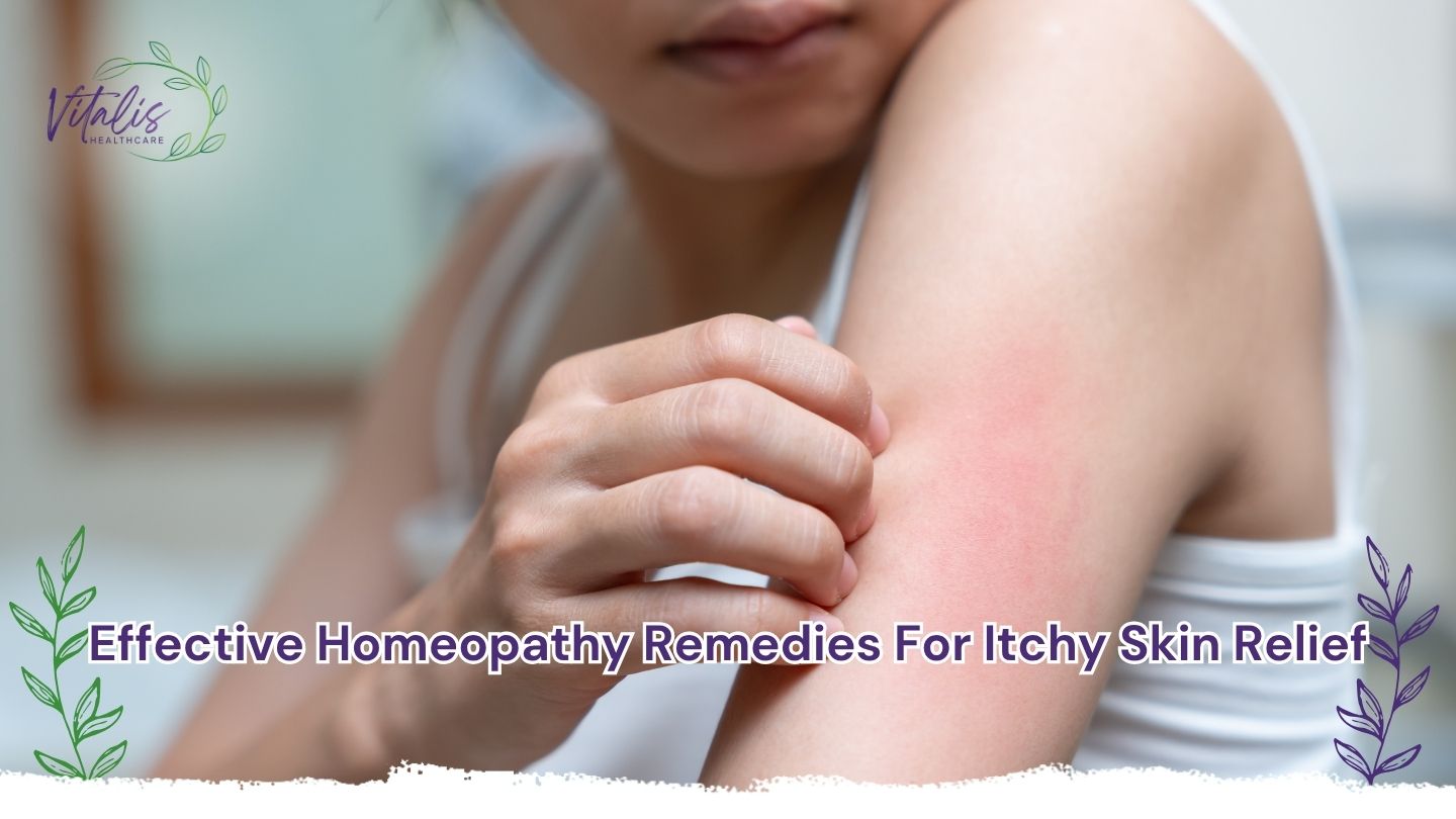 Effective Homeopathy Remedies for Itchy Skin Relief